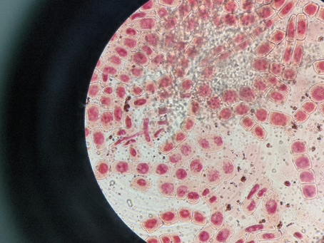 Why Knowing Your Sickle Cell Status Matters—Even If You Feel Healthy
