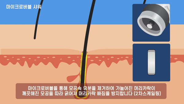 (00-5-100-600)anigif.gif
