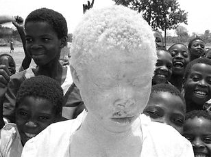albinoafricagirl--_tapu_edited.jpg
