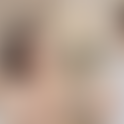 Face Slimming in Singapore 2026: Jaw Botox, HIFU and What Actually Works