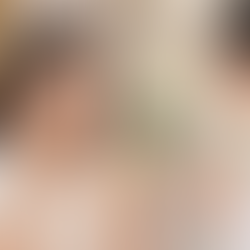 Under Eye Treatment in Singapore 2026: Dark Circles, Eye Bags and Hollows
