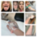 swelling, unexplained, hae, c1 normal, berinert, type 3, throat, IV