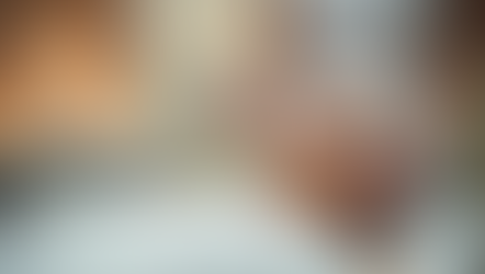 Why Tox Hallandale Leads Non-Surgical Aesthetic Treatments?