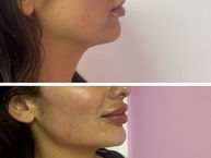 Jaw Definition