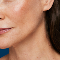 Help replenish lost facial collagen