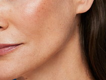 Help replenish lost facial collagen