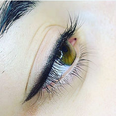 THE DAY OF YOUR TREATMENT (PMU)_- do not