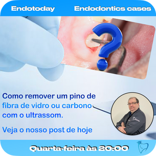 Como remover um pino de fibra de vidro ou carbono com o ultrassom.