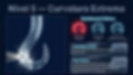 Infográfico azul de Nível 5—Curvatura Extrema, com lima odontológica curva, medidores de risco e textos clínicos.