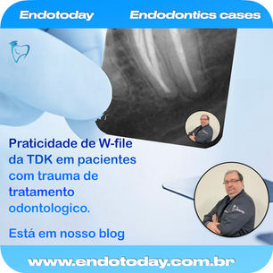 Praticidade de W-file da TDK em pacientes com trauma de tratamento odontologico.