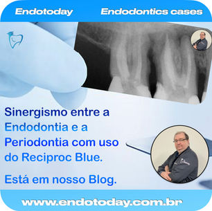 Sinergismo entre a Endodontia e a Periodontia.