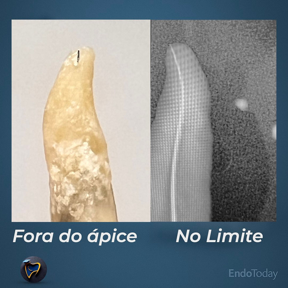 radiografia realiadade