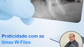 Praticidade com as limas W-Files