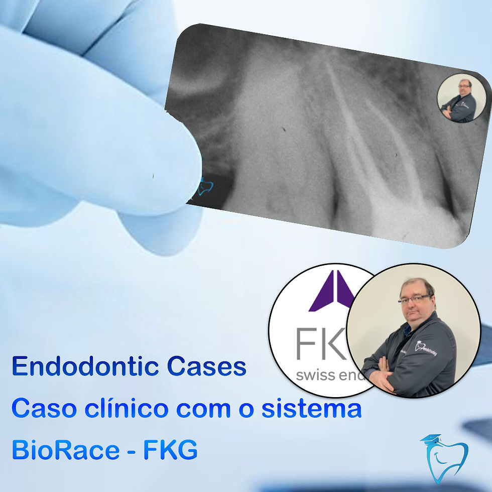 Sistema BioRace, pioneiro na ampliação apical biológica.