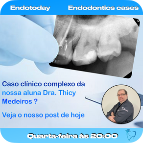 Caso clÃnico com uma lesão endodôntica com efeito periodontal secundário.