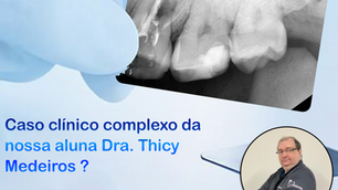 Caso clínico com uma lesão endodôntica com efeito periodontal secundário.