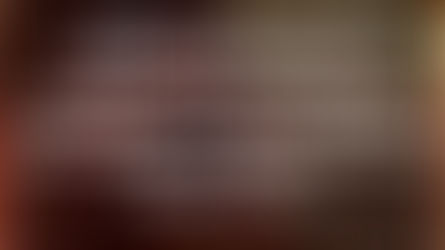 Lesão cística com reabsorção apical e invasão do seio maxilar: abordagem diagnóstica e terapêutica.