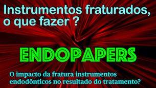 O impacto da fratura instrumentos endodônticos no resultado do tratamento endodôntico.