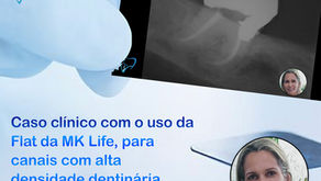 Caso clínico com o uso da Flat da MK Life, para canais com alta densidade dentinária.