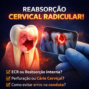 Reabsorção Cervical Externa