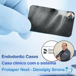 Caso clÃnico com o Protaper Next