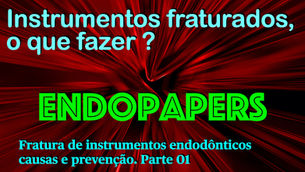 Fratura de instrumentos endodônticos: Causas e prevenção. Parte 01.