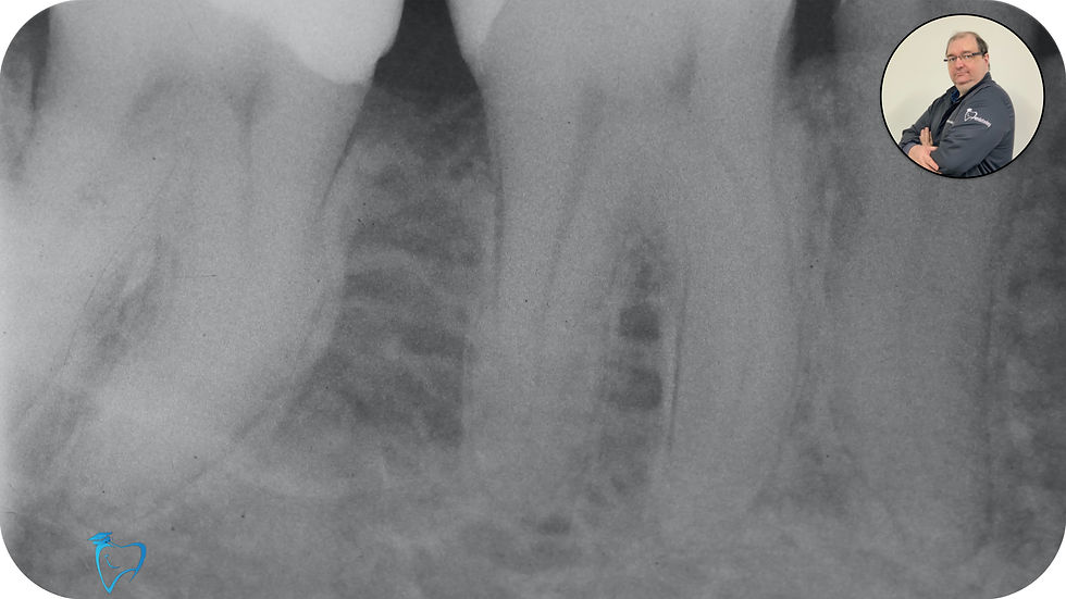 Radiografia Inicial K3XF endotoday