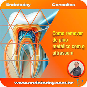 Remoção de pino metálico com o ultrassom - post revisado.