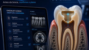 Checklist clínico para abertura coronária segura com radiografia, CBCT e molar em corte.