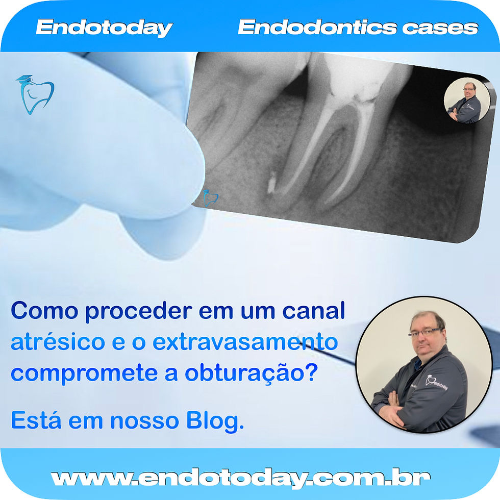 Como proceder em um canal atrésico e o extravasamento compromete a obturação?
