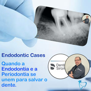 Associação da Endodontia com a Periodontia.