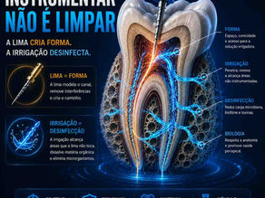 Instrumentar não é limpar: o erro conceitual que compromete a Endodontia
