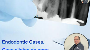 Cone de prata sempre um desafio para o endodontista.