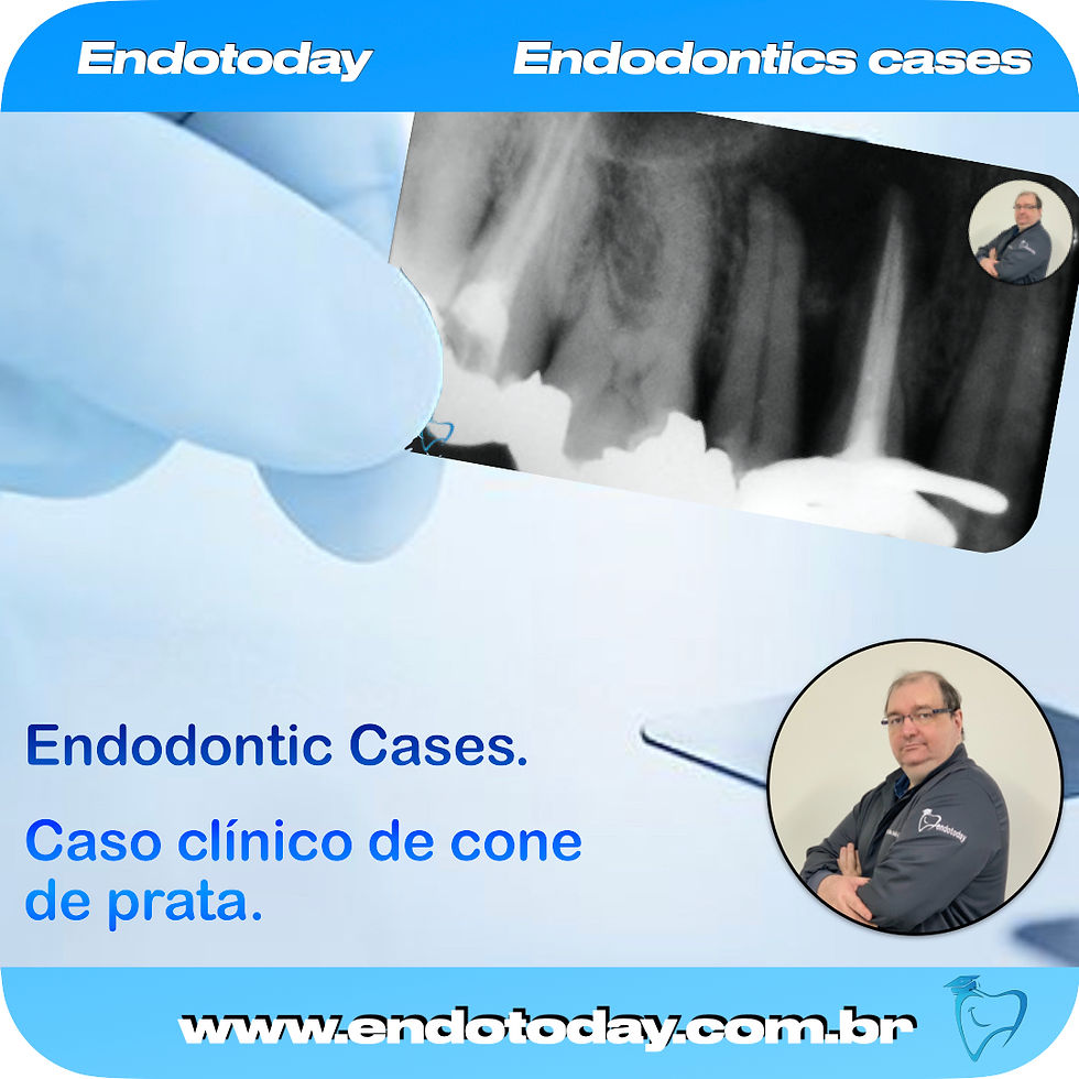 Cone de prata sempre um desafio para o endodontista.