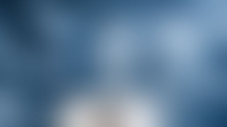 Irrigação e Ativação em Endodontia: O Que Realmente Limpa o Canal Radicular