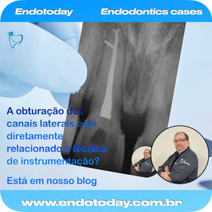 A obturação dos canais laterais está diretamente relacionado a técnica de instrumentação?