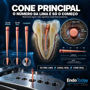 Cone principal: seleção, calibração e adaptação apical