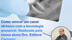 Vencendo um canal atrésico com a tecnologia e dedicação.