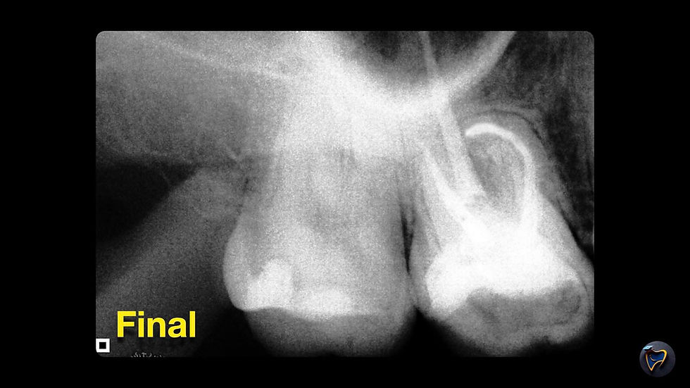 Radiografia final