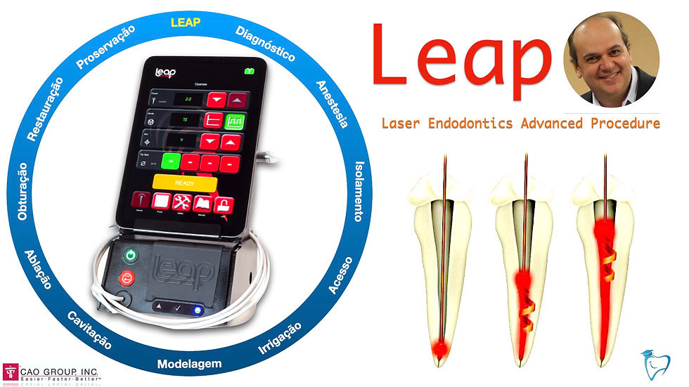 LEAP L:aser endodontics Advanced Procedure