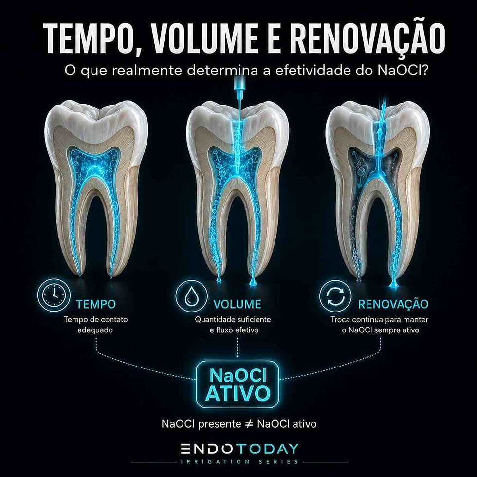 Tempo, volume e renovação: o que realmente determina a efetividade do NaOCl