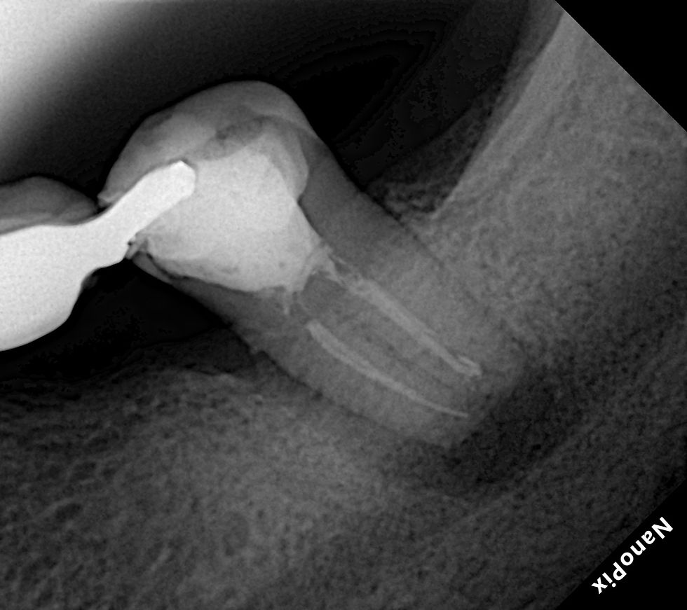 radiografia Inicial