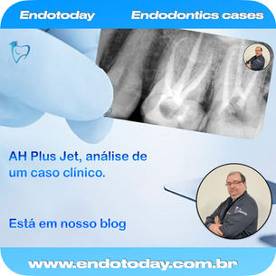 Caso clínico com o sistema A.D.O. da Dentsply para o AH Plus Jet.