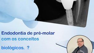Endodontia de pré-molar com os conceitos biológicos. 