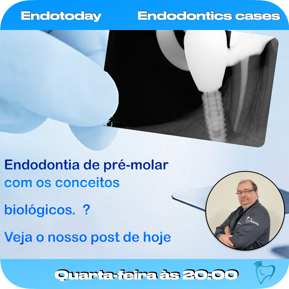 Endodontia de pré-molar com os conceitos biológicos.