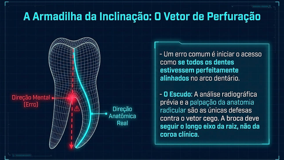 Esquema de dente com seta indicando erro em vermelho e direção correta em azul. Texto: A Armadilha da Inclinação: O Vetor de Perfuração.