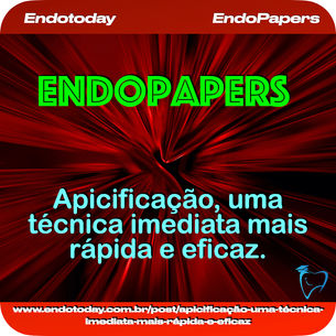 Apicificação, uma técnica imediata mais rápida e eficaz.