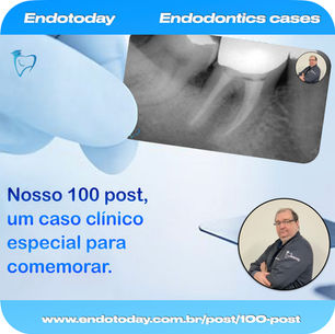 Hoje é um dia especial é o 100 post em nosso site, para isso um caso clínico especial.