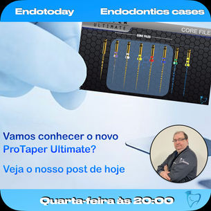 PROPATER ULTIMATE - Novo lançamento da Denstply.