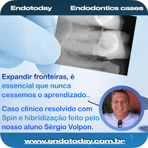 Caso Clínico de Endodontia com Uso do Sistema Spin na AORP por Sérgio Volpon